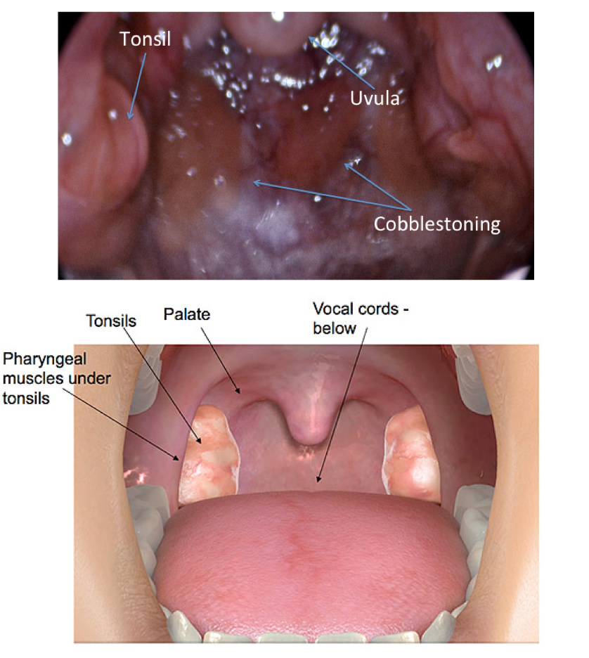 Voice Case Of The Week Voice Doctors As Voice Patients