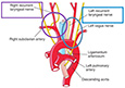 ENT Doctors of OHNI Los Angeles: Parotid Surgeons & Otolaryngologists