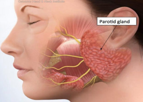 salivary-stones-parotid-tumor-surgery-salivary-gland-surgery-los-my